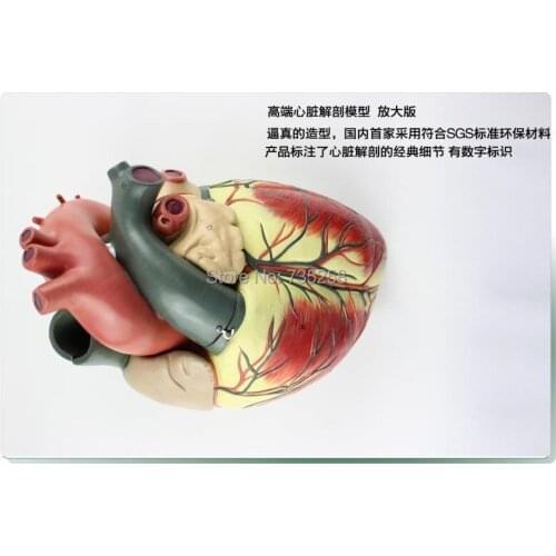 High-end Cardiac Enlargement Model,Human Heart Anatomy Model