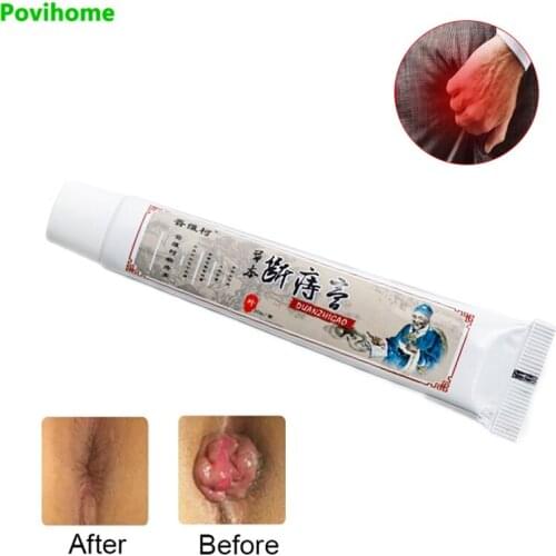 1pcs 20G Hemorrhoids Ointment Relieve Anal Fissure Pain Mint Internal and External Anal Fissure Cream Herbs Medical Plasters