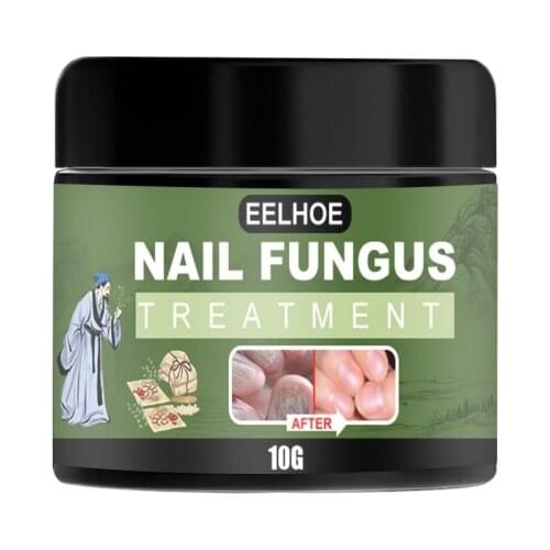 1Pcs Onychomycosis Fungal Nail Treatment Paronychia Anti Infection Feet Toe Fungal Nail Care Nail Fungus Removal Cream