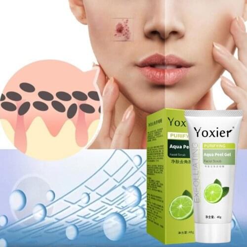 Exfoliating Face Scrub Peeling Gel Moisturizing Whitening Remove Detoxifies Cleanses Vitamin C Lemon Acne Skin And All S1Z0