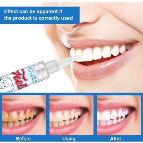 1Pcs Teeth Whitening Pen Cleaning Serum Remove Plaque Stains Dental Tools Whiten Teeth Oral Hygiene Tooth Whitening Pen