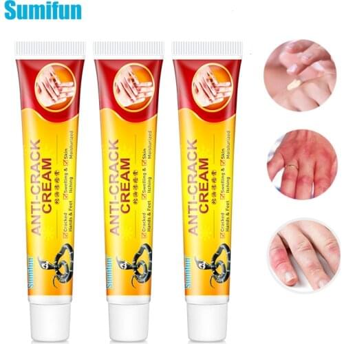 1/2/3pc Anti-Cracking Cream Frozen Frostbite Snake Oil Anti-Chapping Repair Skin Ointment Anti Dry Aanti-Itching Moisturizer Oil