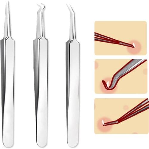 1pc 3-types Beauty Skin Care Tool Bend Curved Facial Extractor Blackhead Acne Blemish Remover Tweezers Needle Tool