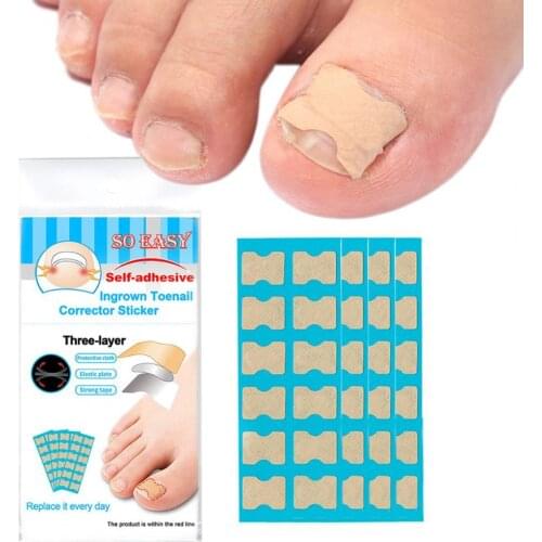 Ingrown Toenail Corrector Stickers Paronychia Treatment Pedicure Toe Nail Care Corrector Patch Correction Stickers 120Pcs