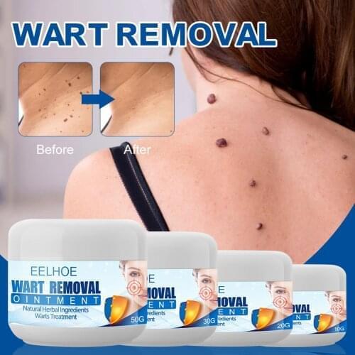 Wart Remover Ointment Safe Painless Skin Tags Removal Ointment Fast Acting Remover Cream for Warts Moles Corn for All Skins