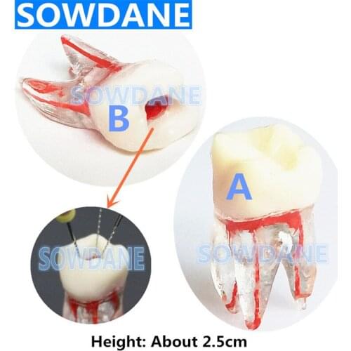 2pcs/4pcs 1:1 Resin Dental Endodontic Student Study Practice Operation Model Colored Root Canal and Pulp Clear without files