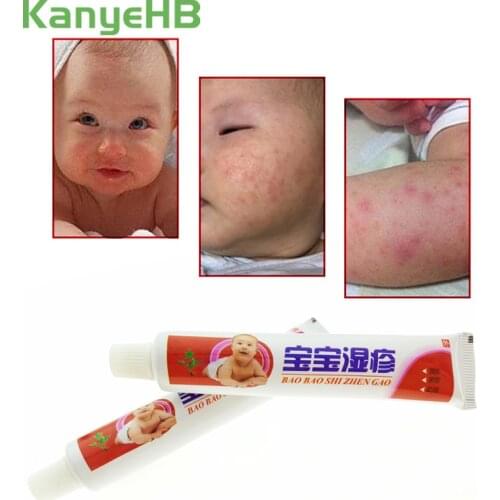 1pcs Baby Eczema Cream Psoriasis Pruritus Dermatitis Itching Repair Skin Chinese Herbal Medical Plaster Ointment S011