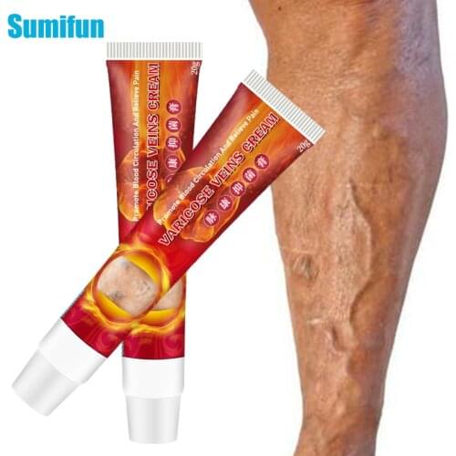 Sumifun 20g Varicose Veins Cream Treatment Vasculitis Phlebitis Spider Leg Swelling Pain Relief Ointment Medical Plaster P1109