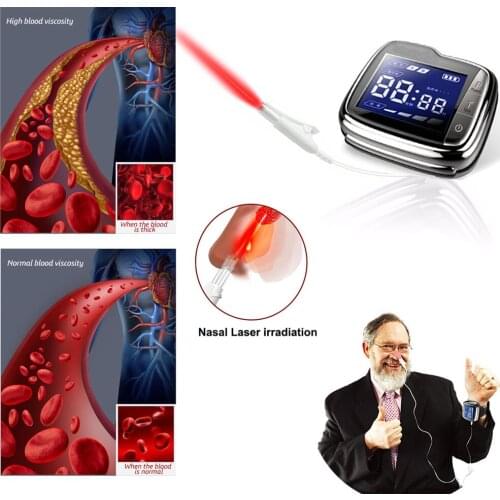 650nm Light Wave Laser Therapy Wrist for Diabetes Hypertension Purify Blood Treatment Watch Laser Sinusitis Laser Illuminator
