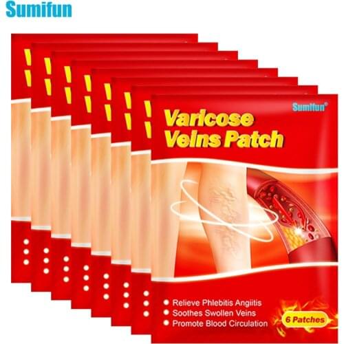 Sumifun 6/18/30/48pcs Chinese Varicose Veins Plaster Vasculitis Phlebitis Spider Leg Medical Patch Angiitis Removal Patch