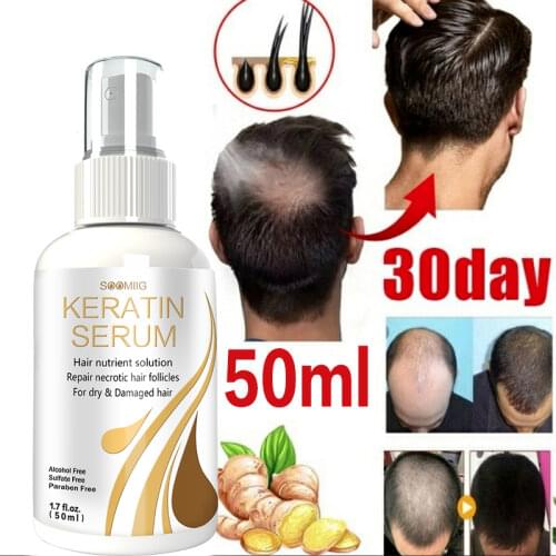 Mosslay Hair Loss Remedies