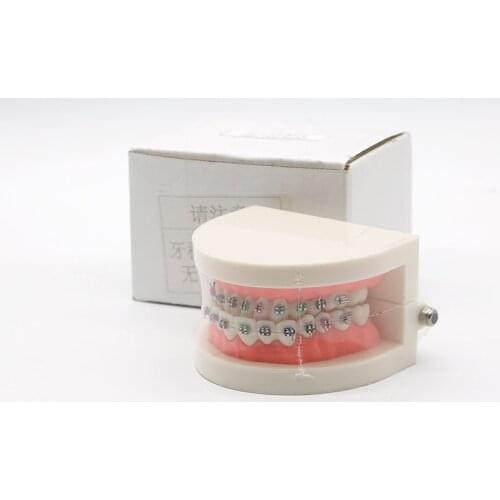 Dental Orthodontic Treatment Model With Ortho Metal Ceramic Bracket Arch Wire Buccal Tube Ligature Ties Dentist Tools Lab