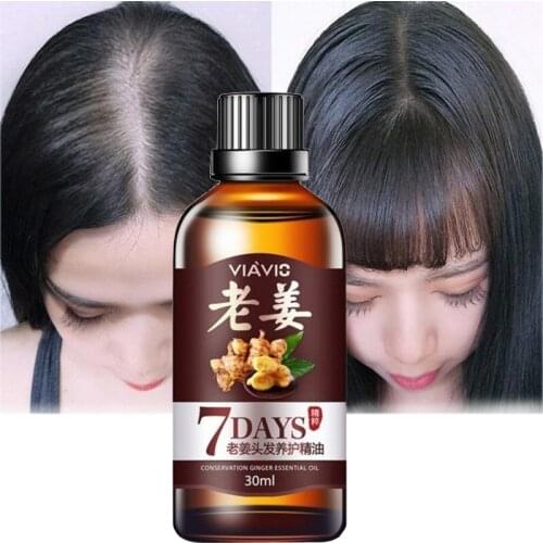 1pcs Ginger Essence Hair Growth Serum Women Men Treatment Hair Loss Liquid 30ml Regrowth Essential Oil for Care Dry Hair