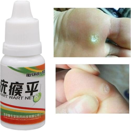 12 Hours Black Dots Mole Wart Skin Tag Remover Liquid Medical Corn Removal Foot Genital Care Mole Removal Papillomas Treatment