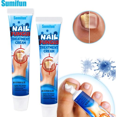 1Pcs Nail Fungus Removal Cream Onychomycosis Fungal Nail Treatment Paronychia Anti Infection Feet Toe Fungal Nail Care Ointment