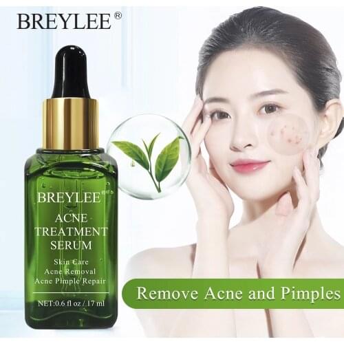 Cosmetic Acne Treatment Face Serum Mask Anti Acne Pimple Scar Remover Moisturizing Whitening Skin Care Facial Essence Cream 17ml