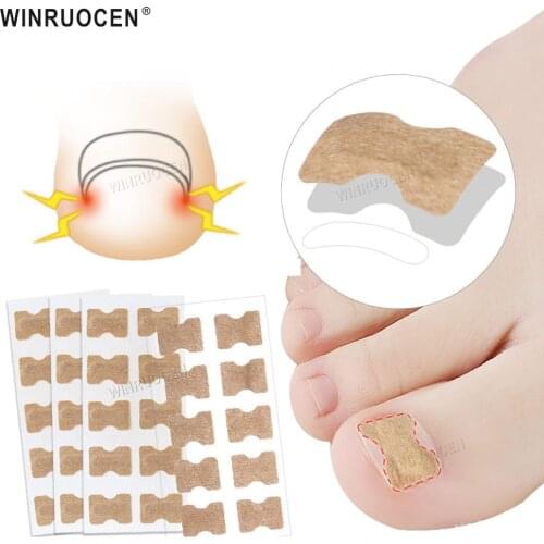 10-50Pcs Ingrown Toenail Corrector Sticker Paronychia Treatment Recover Corrector Pedicure Foot Toe Nail Care Tool Elastic Patch