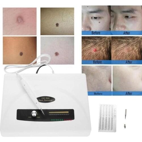 Ultrasonic Spot Removal Pen Large Power Freckle Tattoo Mole Removal Plasma Wart Remover Pen Home Spa Skin Care Machine