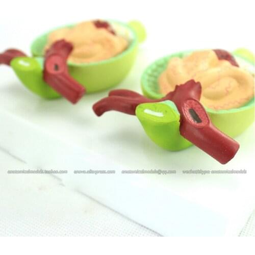 CMAM/12436 Nephron Diseases, 300X Life size, Genitourinary Medical Teaching Anatomical Model