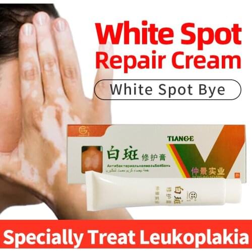 30g Leukoplakia Disease Treatment Cream Chinese Medical Vitiligo Skin Antibacterial Balm