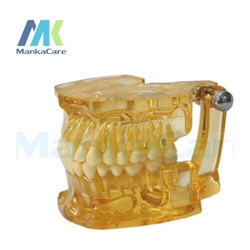 Manka Care - Clear Extraction Model Oral Model Teeth Tooth Model