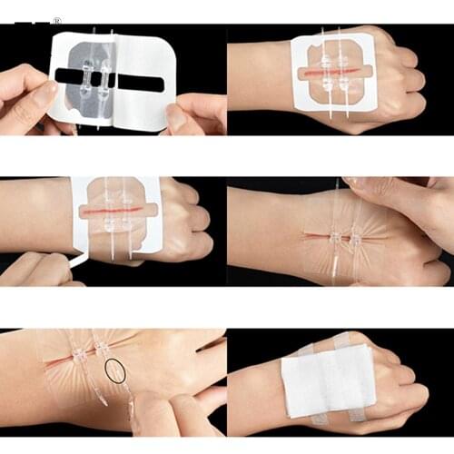 1/2Pcs Zipper Band-aid Painless Wound Closure Device Dressing Patch Zip Suture
