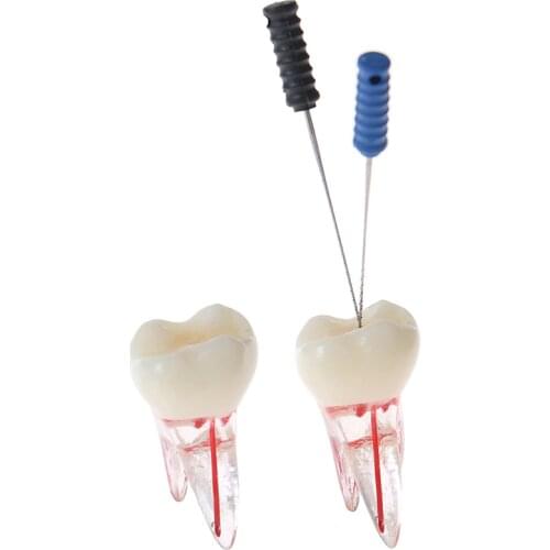 1:1 Resin Dental Endodontic Student Study Practice Model With Colored Root Canal And Pulp Transparent Without Files
