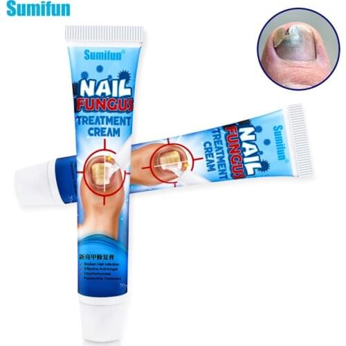 Sumifun 2pcs Effect Fungus Repair Cream Nail Fungus Removal Anti Onychomycosis Feet Care Treatment Restores Itch Odor Ointment
