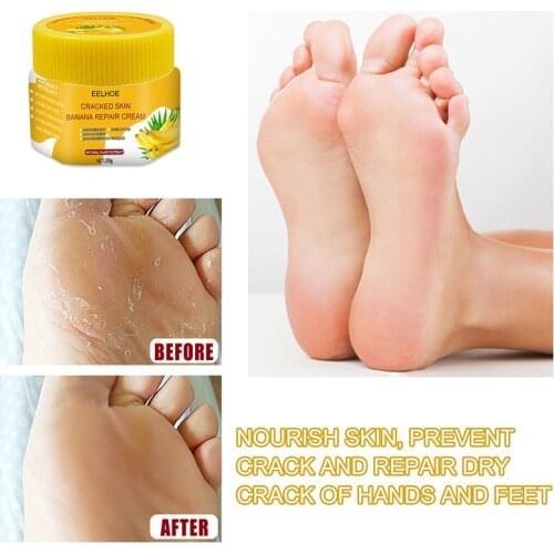 Увлажняющие маски для ног Ibcccndc China At AliExpress