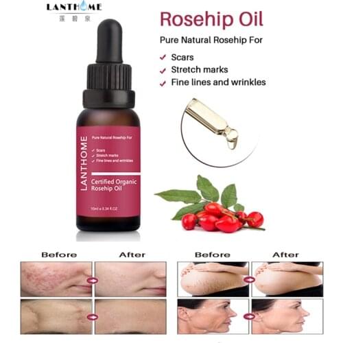 Lanthome Rosehip Oil Moisturizing Essence Lighten Acne Print Scar Stretch Marks Whitening Skin Care Face Serum 10ml TSLM1