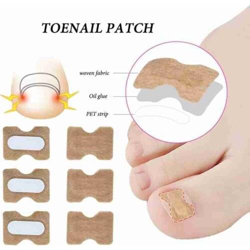 10pcs Ingrown Toenail Corrector Sticker Embedded Toe Nail Corrector Sticker Toenail Care Pedicure Thumb Curl Correction Sticker