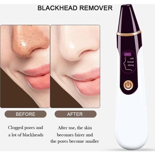 Facial Blackhead Remove Machine Vacuum Visualization Blackhead Remove Deep Nose Cleaner Pore Acne Face Care Cleansing Skin Tool