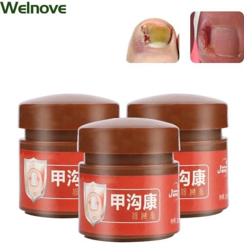 20g Foot Fungal Nail Ointment Treat Nail Fungus Promote Toenail Growth Cream Anti Infection Paronychia Onychomycosis Plaster