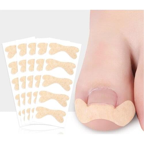 5Pcs Ingrown Toenail Corrector Sticker Toe Foot Nail Care Tool Nail Sticker Paronychia Treatment Fixer Corrector