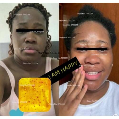 LIGHTENING Skin Soap, Face & Body Wash, Deep Skin Cleanser, ACTIVE & EFFECTIVE