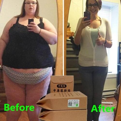 30Pcs Slimming Patch Burning Fat Sticker Slimming Diets Weight Loss Slim Patch Pads Detox Adhesive Sheet Face Lift Tool