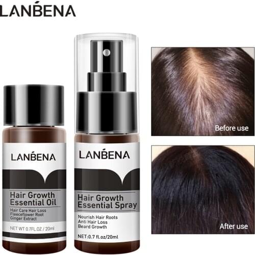 LANBENA Fast Hair Growth Essence Spray Preventing Nourish Roots Ginger Extract Treatment Hurt Hair Product Nourish Roots Care