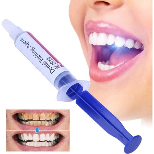 Dental Etching Agent 37% Phosphoric Acid Etch Polymer Thickened Semi-Gel Type Syringe Treat Enamel Dentin Teeth Care Kit Tools