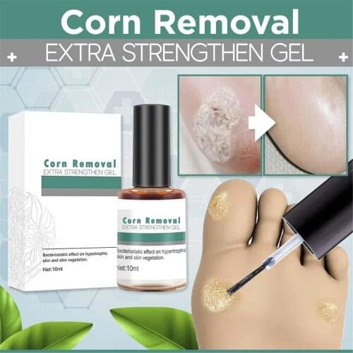 Corn Removal Extra Strengthen Gel 10ml Body Warts Treatment Cream Foot Care Cream Skin Tag Remover Remover Foot Corn Care Cream