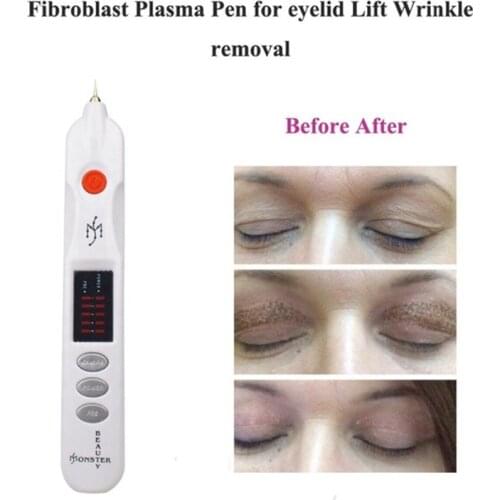 2019 High Power Fibroblast Plasma Pen for Mole Dark Spot Wart Tattoo Wrinkle Removal Face Eyelid Lift Plasmapen