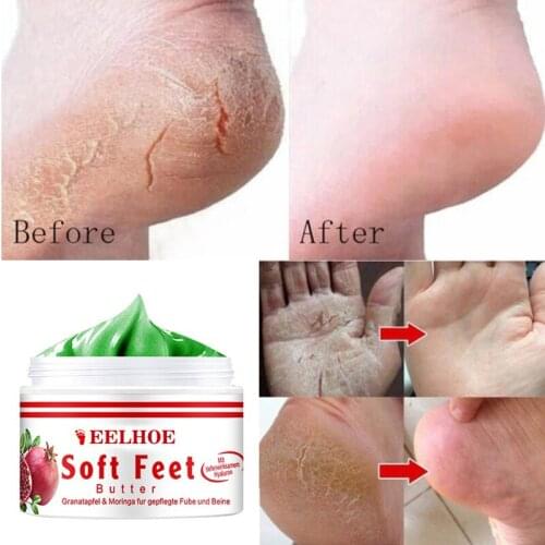 50g Oil Anti-Drying Crack Foot Cream Anti Dry Skin Cream Hand And Foot Repair Cream Removal Dead Skin Hand Feet Care Repair Skin