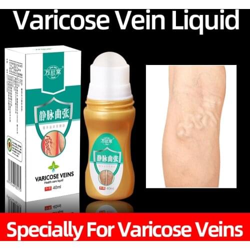 Natural Herbal Medicine Varicose Veins Health Care Spray Treatment Angitis Vein Pain Phlebitis Liquid