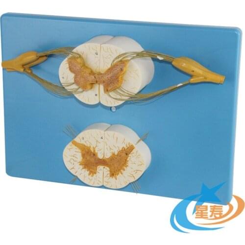 Human Spinal Nerve Branch Enlargement Model Cross Section of Spinal Cord Three-dimensional Morphology of Spinal Cord Nerve