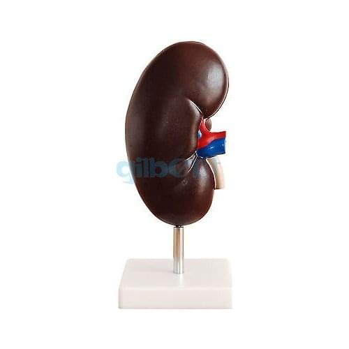 2 Times Enlarged Human Kidney With Adrenal Glands Anatomical Medical Model