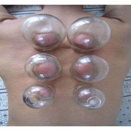 5size 2pcs/set Glass Cupping Fire Cup Chinese Suction Body Massage Therapy Medical thickening glass vacuum cupping jar can tank