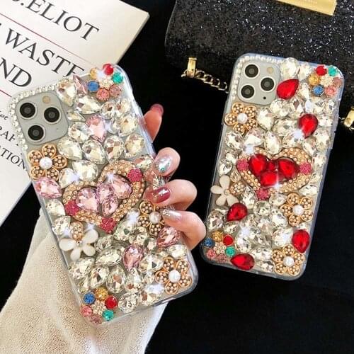 XiongMuZhang Xiaomi Mi 11 Phone Cases