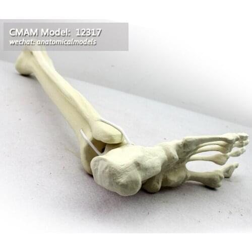 12317/ CMAM Model,Simulated bone, foot+tibia+fibula, Medical Orthopaedic Operative Training Model
