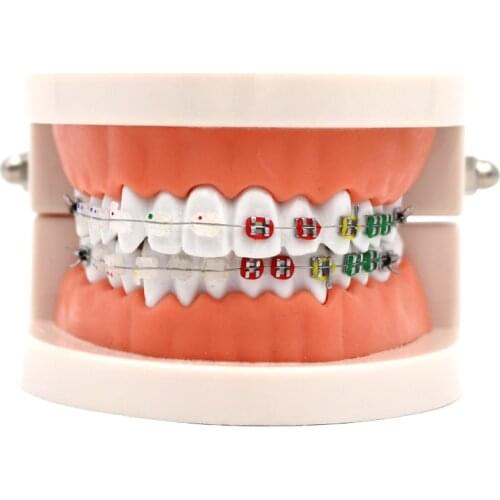 1pc Dental Orthodontic Model Half Ceramic Half Metal Bracket With Anti-nail For Dentist Medical Disease Teaching Study
