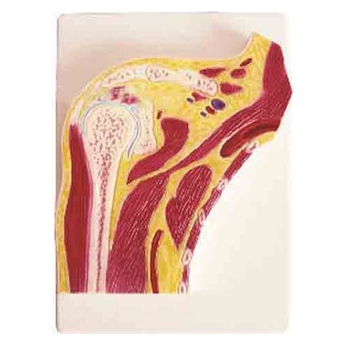 Smd02519 shoulder joint profile model