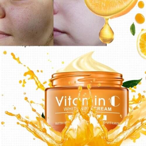 DISAAR Vitamin C VC Whitening Facial Cream Repair Fade Freckles Remove Dark Spots Melanin Remover Brightening Face Cream